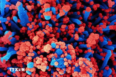 Hình ảnh quét qua kính hiển vi điện tử cho thấy tế bào (màu xanh) bị virus SARS-COV-2 (màu đỏ) xâm nhập. (Ảnh: AFP/TTXVN) 