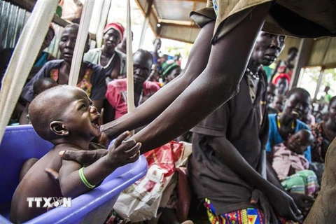 Trẻ em bị suy dinh dưỡng đợi khám bệnh tại Ghazal, Nam Sudan. (Ảnh: AFP/TTXVN) 