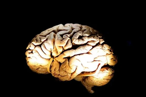Não bị “lão hóa” là tình trạng các tế bào não “bị bệnh” hoặc “già hóa” hiện diện với số lượng lớn và tiết ra các chất có hại ngăn cản hoạt động bình thường và phục hồi của các tế bào não xung quanh. (Nguồn: AFP/GettyImages)