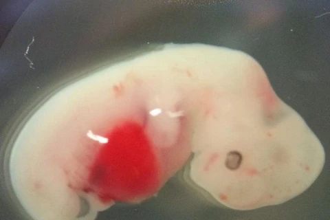 Hình ảnh phôi lợn được cấy tế bào con người. (Nguồn: National Geographic)