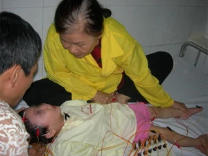 Một bé 2 tuổi rưỡi đang được châm cứu chữa bệnh bại não. (Nguồn: vnexpress.net).