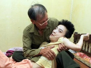 Một nạn nhân bị chất độc da cam/dioxin ở Thanh Hóa. (Ảnh: Nguyễn Thủy/TTXVN)