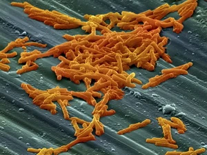 Hình dạng loại siêu vi khuẩn kháng thuốc có tên Clostridium difficile dưới kính hiển vi đã được phát hiện ở châu Âu gần đây. (Ảnh: khoahoc.com.vn)