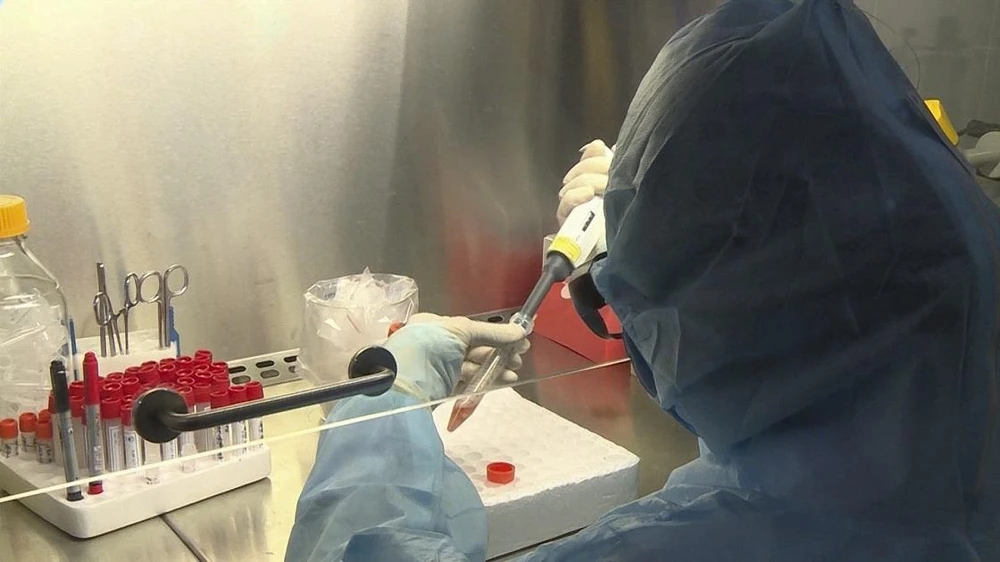 Cán bộ Trung tâm Kiểm soát bệnh tật tỉnh Điện Biên xét nghiệm các mẫu bệnh phẩm nghi ngờ nhiễm virus SARS-CoV-2. (Ảnh: TTXVN)