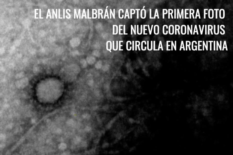 Hình ảnh virus SARS-CoV-2 mà các nhà khoa học Argentina chụp được. (Nguồn: pagina12.com.ar)