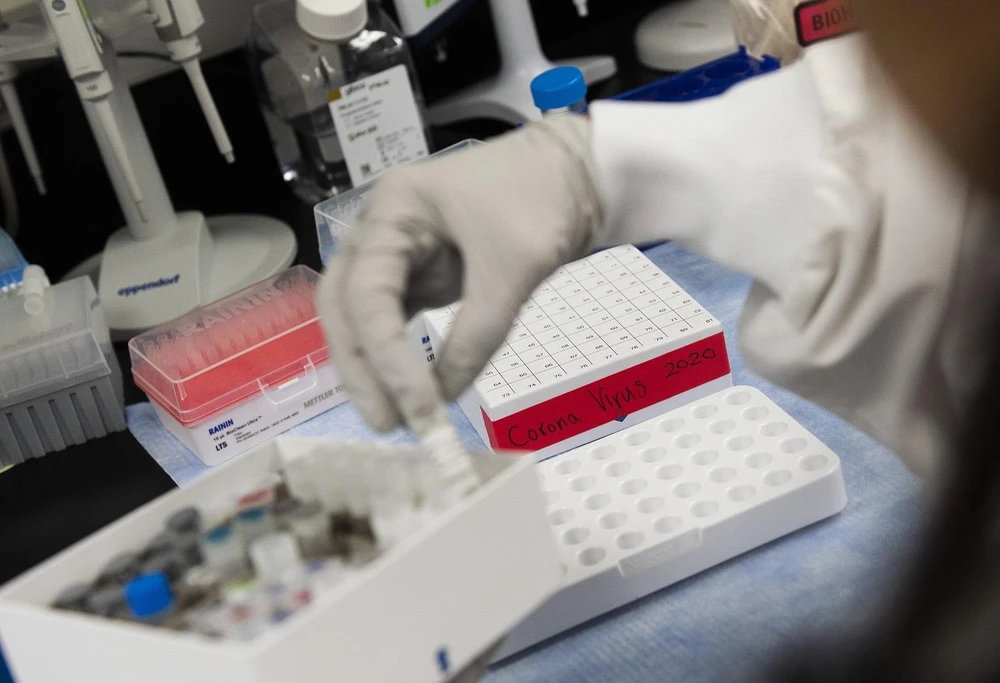 Nghiên cứu mẫu bệnh phẩm để bào chế vắcxin phòng COVID-19 tại phòng thí nghiệm của Novavax ở Gaithersburg, bang Maryland, Mỹ. (Ảnh: AFP/TTXVN)