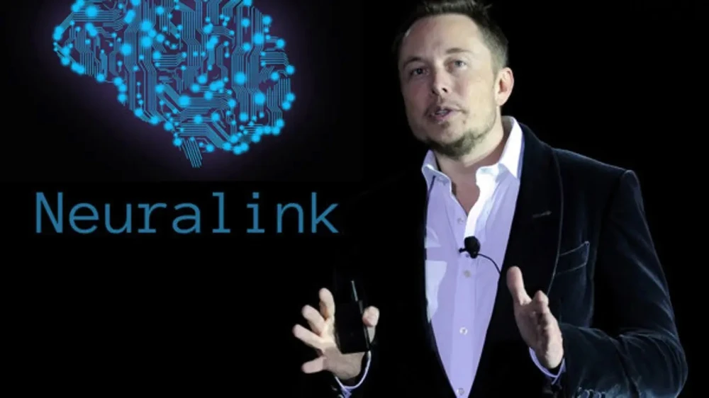 Ellon Musk hé lộ thông tin đặc sắc về người đầu tiên được cấy chip não Neuralink