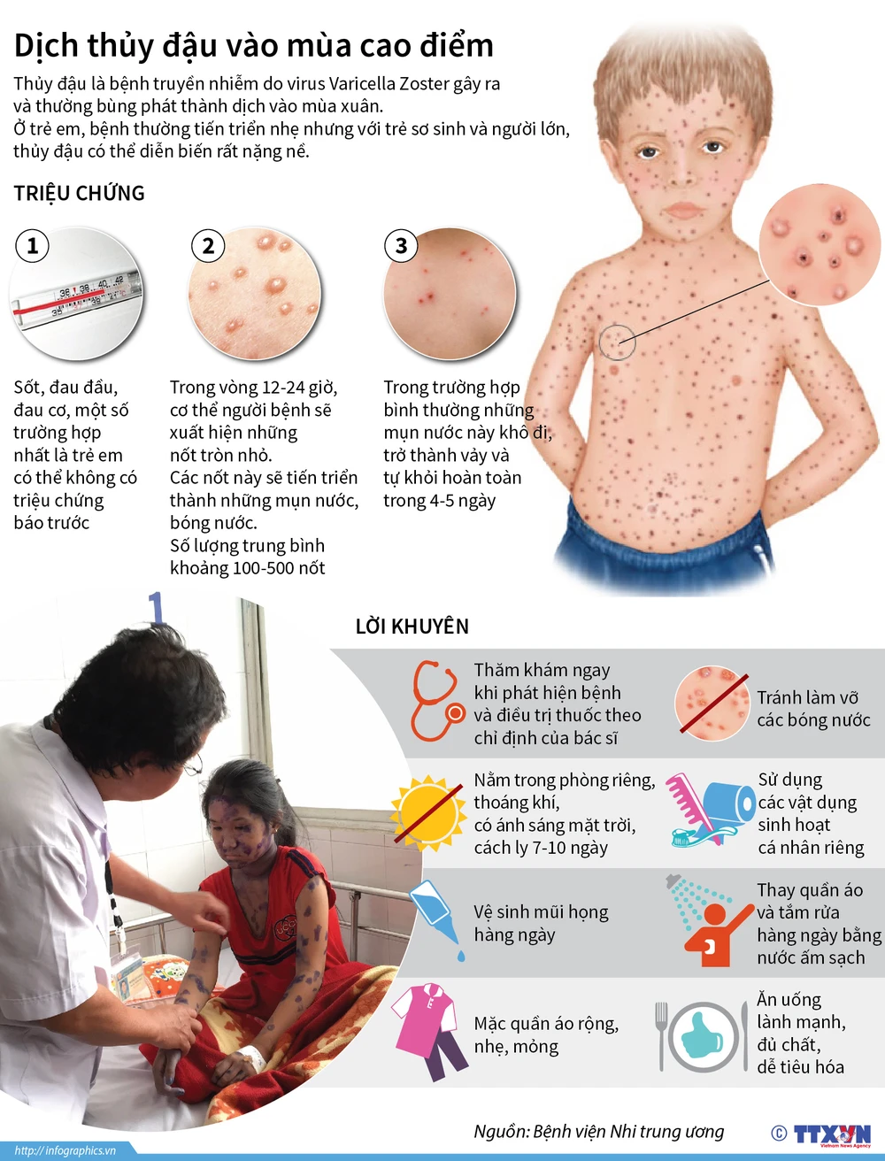 Infographics] Những triệu chứng thường gặp của bệnh thủy đậu ...