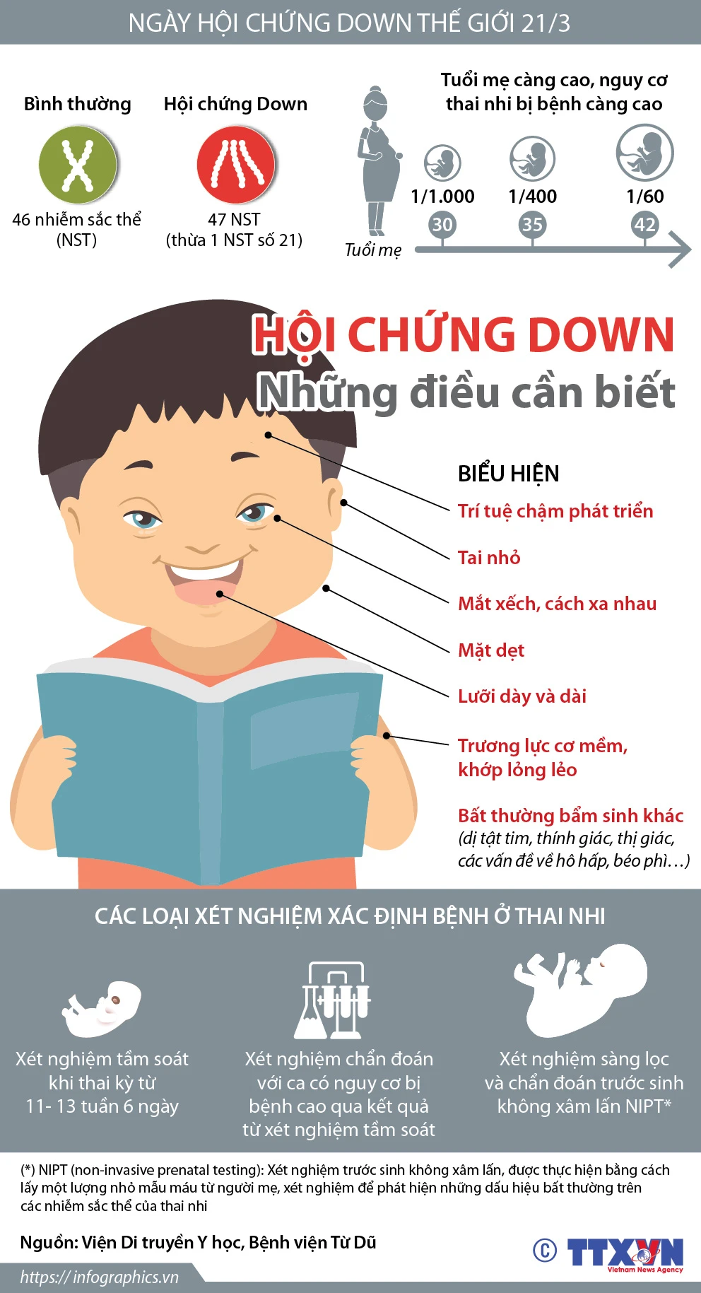 Hỗ Trợ Và Điều Trị Cho Trẻ Mắc Hội Chứng Down