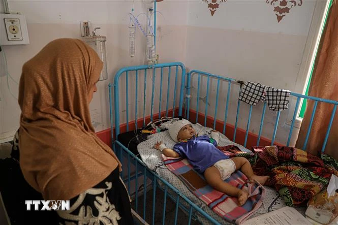 Em nhỏ bị thương do xung đột Israel-Hamas được điều trị tại Bệnh viện ở Khan Younis, Dải Gaza. (Ảnh: THX/TTXVN)