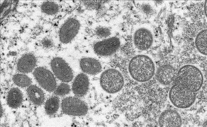 Hình ảnh virus đậu mùa khỉ dưới kính hiển vi điện tử. (Ảnh minh họa: AFP/TTXVN)