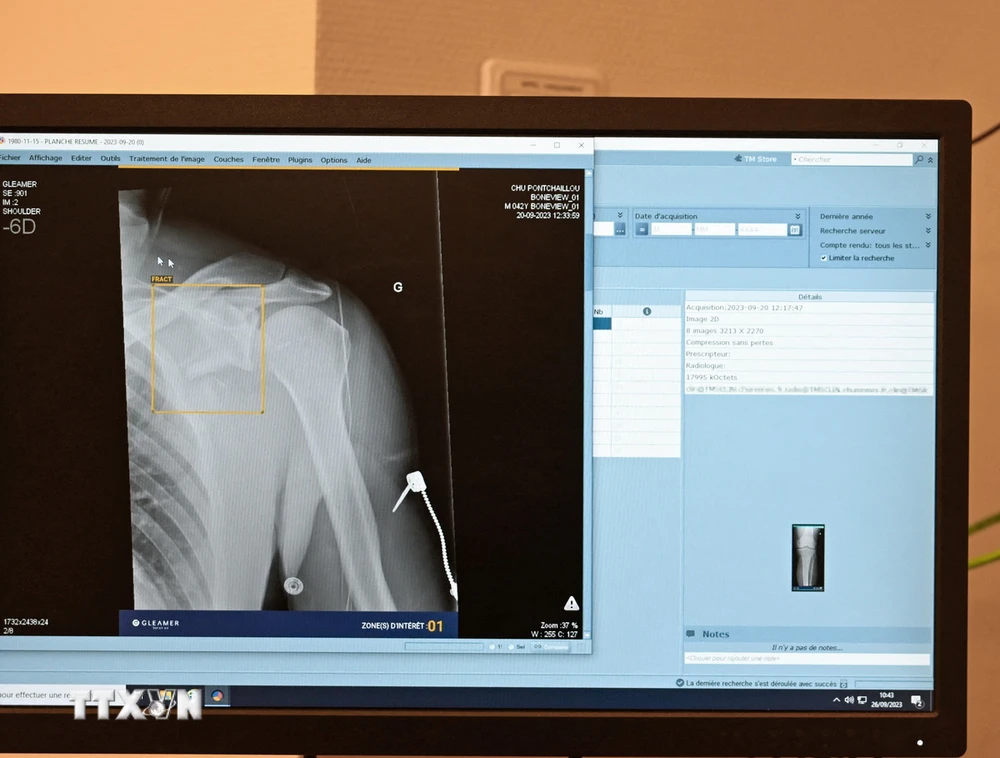 Trí tuệ nhân tạo được ứng dụng trong chụp phim X-quang. (Ảnh: AFP/TTXVN)
