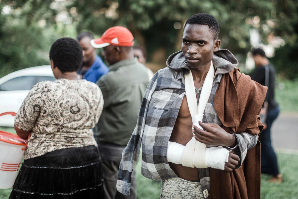 Anh Barnard Hamis đến từ Malawi bị thương trong vụ bạo lực tấn công người nước ngoài tại khu vực ngoại ô Durban, Nam Phi ngày 27/3. (Ảnh: AFP/TTXVN) 