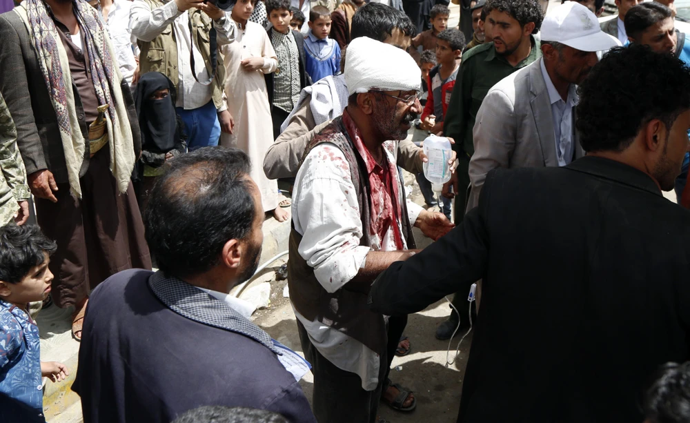 Nạn nhân bị thương tại hiện trường một vụ không kích ở Sanaa, Yemen, ngày 7/4/2019. (Ảnh: THX/TTXVN) 