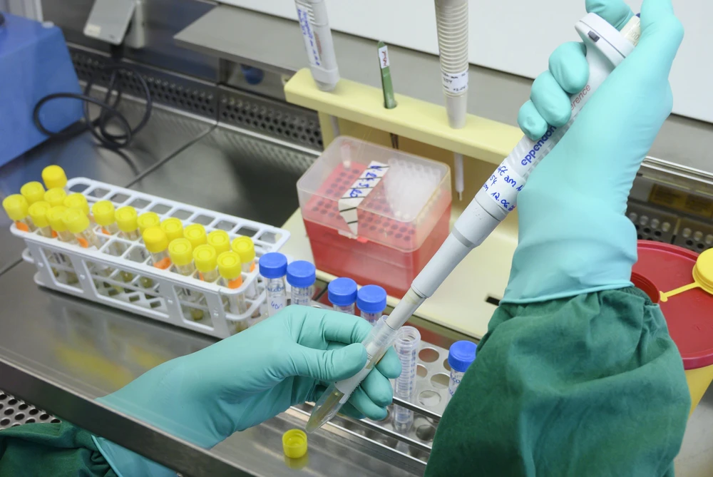 Nhân viên y tế xét nghiệm các mẫu bệnh phẩm COVID-19 tại phòng thí nghiệm ở Stuttgart, miền nam Đức, ngày 2/3/2020. (Ảnh: AFP/TTXVN)