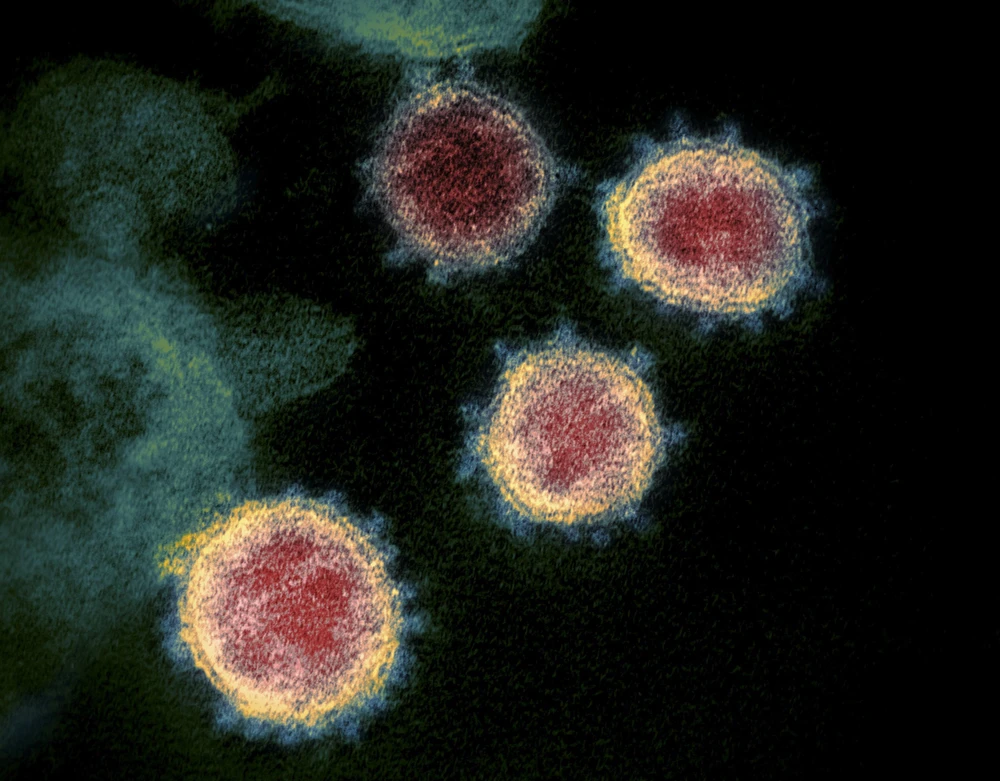 Virus SARS-CoV-2 gây bệnh COVID-19 soi trên kính hiển vi. (Ảnh: AFP/ TTXVN)