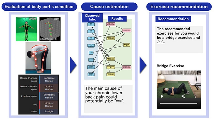 Công nghệ AI hỗ trợ cải thiện chứng đau lưng mãn tính. (Nguồn: NEC)