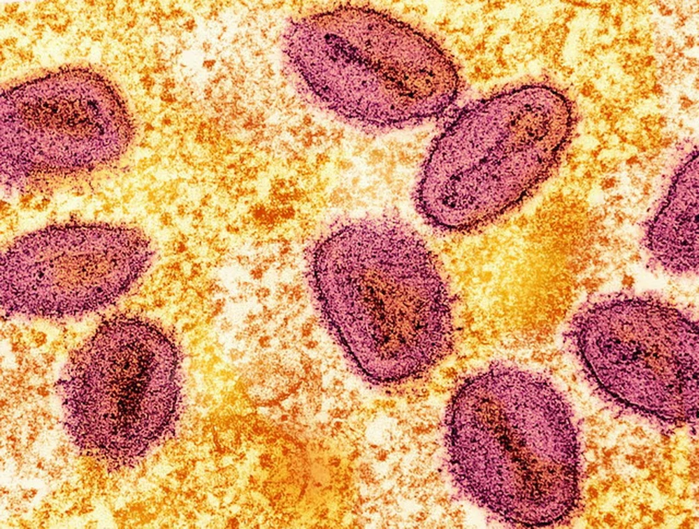 Virus đậu mùa khỉ. (Ảnh: Reuters)