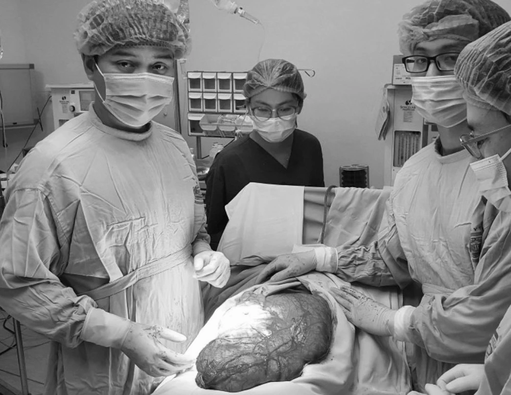 Các bác sĩ thực hiện ca phẫu thuật cắt khối u cho bệnh nhân. (Ảnh: PV/Vietnam+)