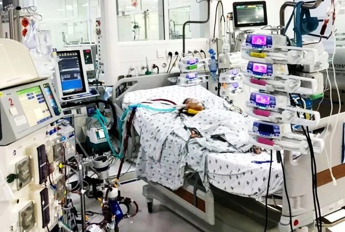 Bé gái bị ong đốt nguy kịch phải chạy ECMO, lọc máu liên tục (Ảnh: Bệnh viện Nhi đồng Thành phố)