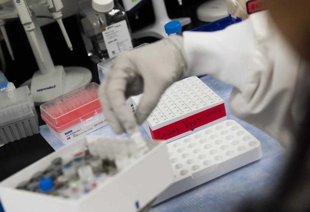 Nghiên cứu mẫu bệnh phẩm để bào chế vắcxin phòng COVID-19 tại phòng thí nghiệm ở Mỹ. (Ảnh: AFP/TTXVN)