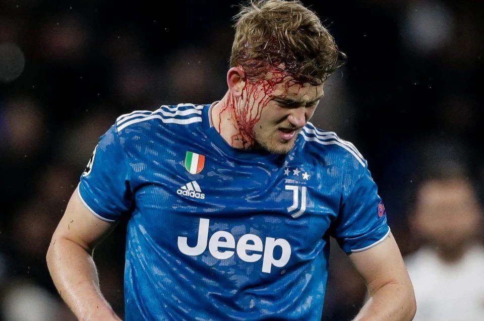 Trung vệ De Ligt gặp chấn thương vùng đầu trong trận Juventus thua 0-1 Lyon rạng sáng 27/2. (Ảnh: Getty Images)