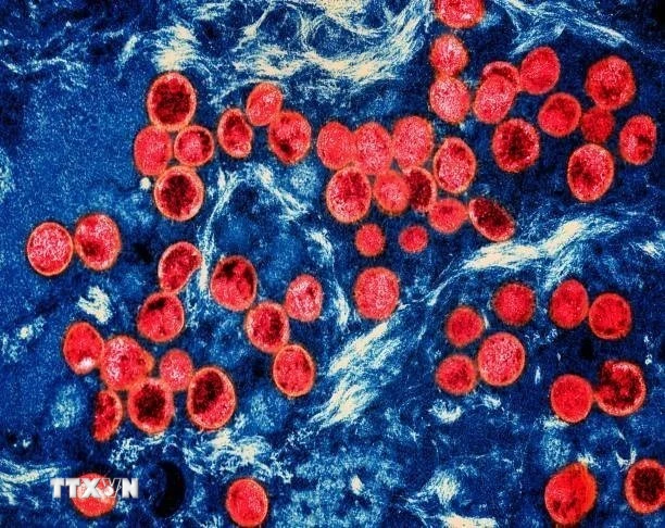 Hình ảnh virus đậu mùa khỉ dưới kính hiển vi. (Ảnh: Getty Images/TTXVN)