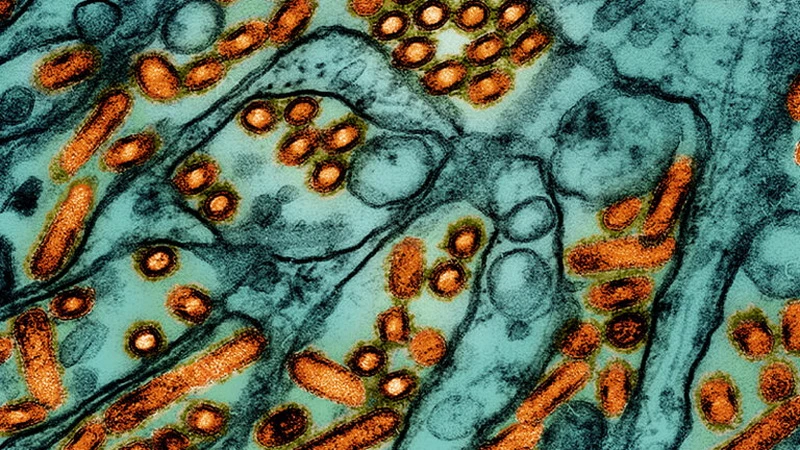 Các hạt virus cúm gia cầm H5N1 (màu cam) dưới kính hiển vi. (Nguồn: Statnews)