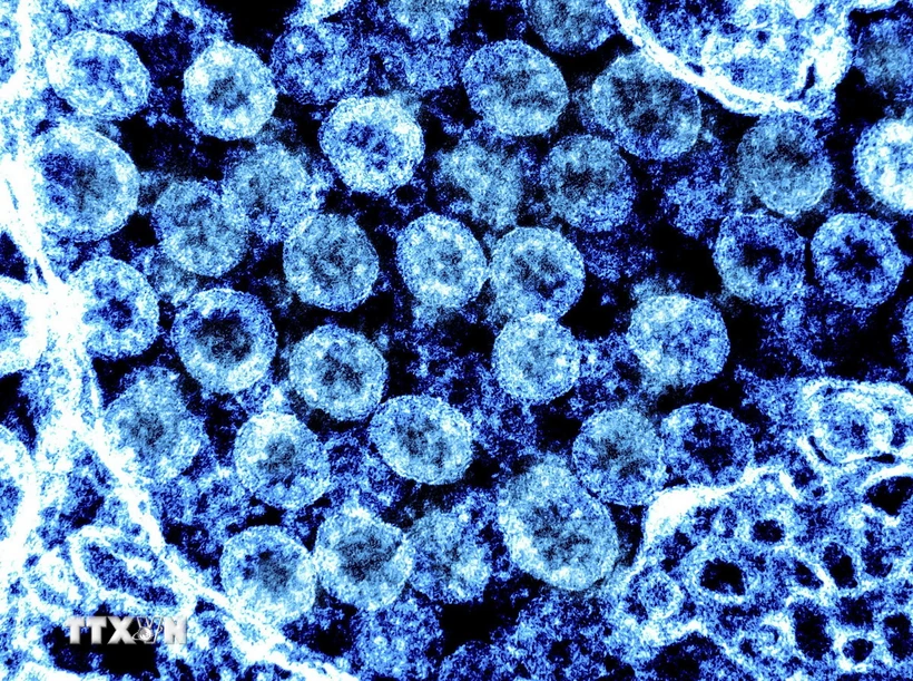 Hình ảnh từ kính hiển vi do Viện nghiên cứu bệnh truyền nhiễm và dị ứng quốc gia Mỹ cung cấp cho thấy virus SARS-CoV-2 trong mẫu bệnh phẩm của bệnh nhân mắc COVID-19. (Ảnh: AFP/TTXVN)